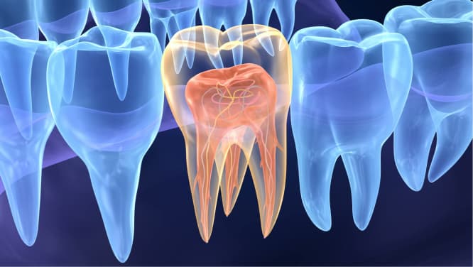 imagem raio x 3d de demonstração de elementos internas de dente, procedimento odontológico, cirurgia parendodontica, endodontia