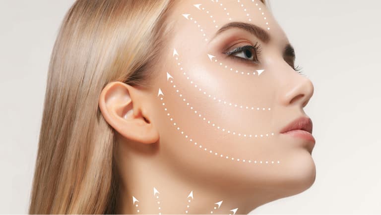 imagem rosto de mulher com linhas circulares, fios faciais, procedimento harmonização orofacial